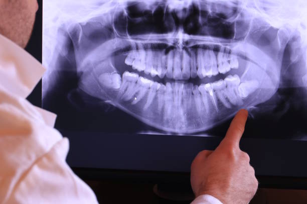Best Urgent Tooth Repair  in Port Isabel, TX