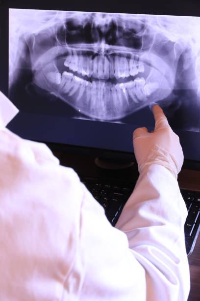 Best Chipped Tooth Repair Near Me  in Port Isabel, TX